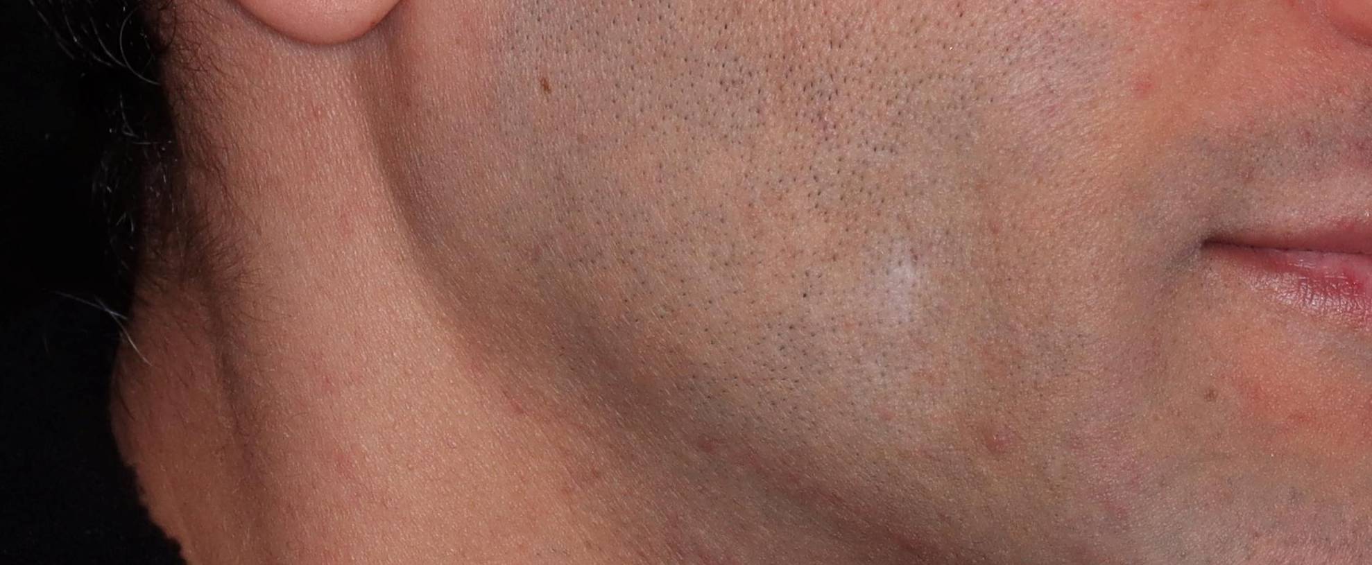 Genius Scar - Case #3 Before