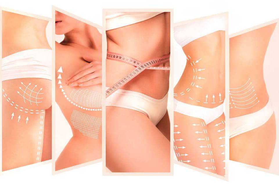 Liposuction Treatments