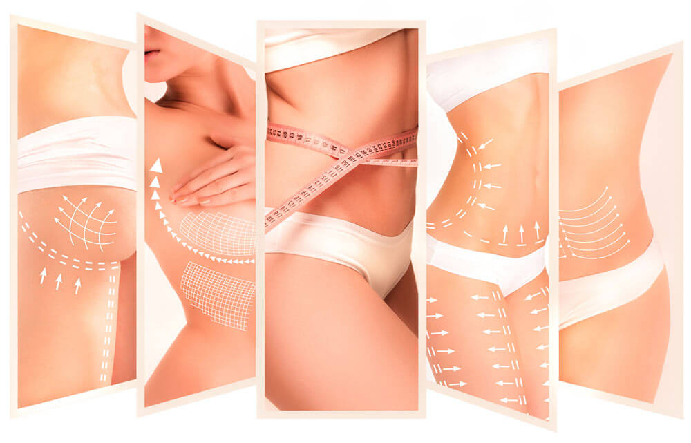 Liposuction Treatments