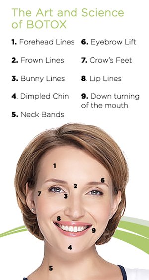 BOTOX treatment areas for the face.