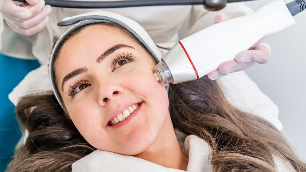 Genius: RF MicroNeedling - 20% OFF